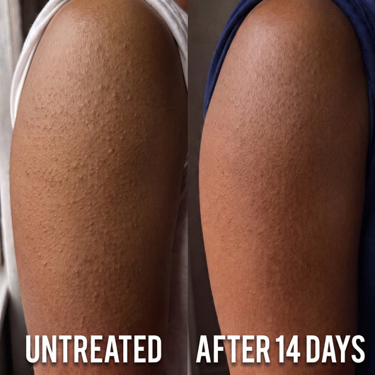 Smooth, Clear Skin That Actually Lasts With Leravian